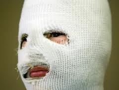 Tiranë, sulmohet me acid në fytyrë  27-vjeçarja